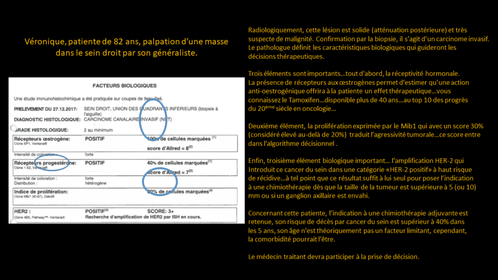 Réponse carcinome