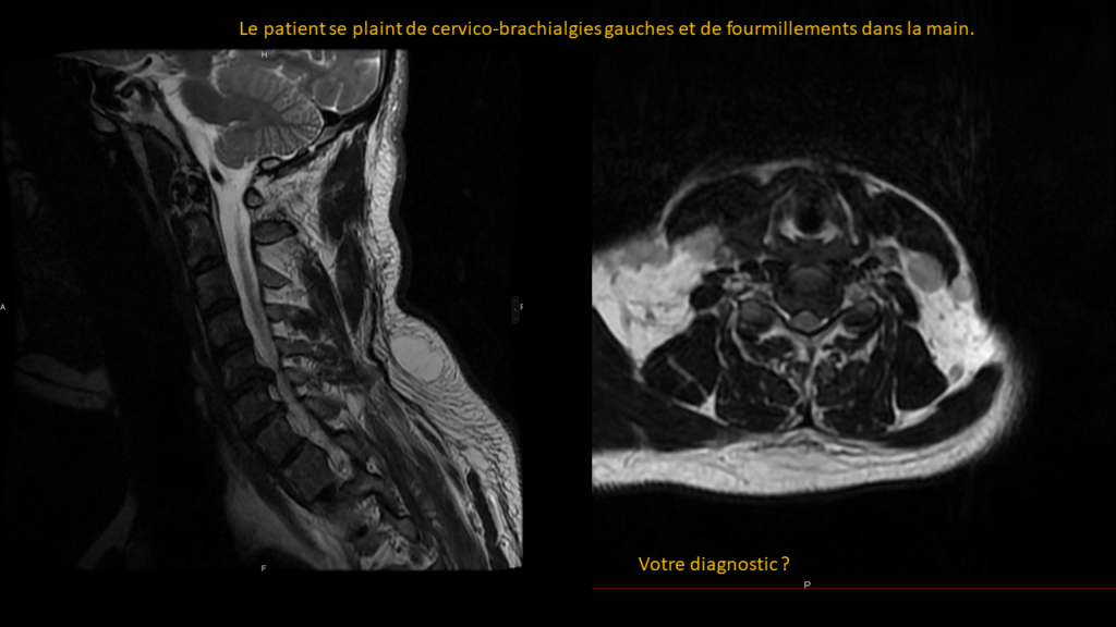 Question Cervical