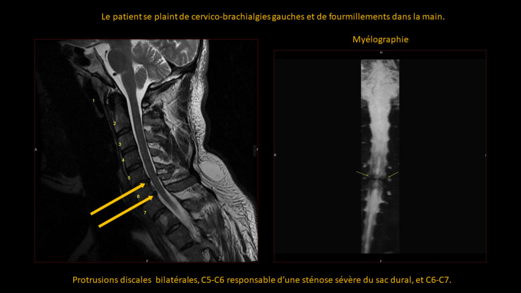 Réponse cervicale