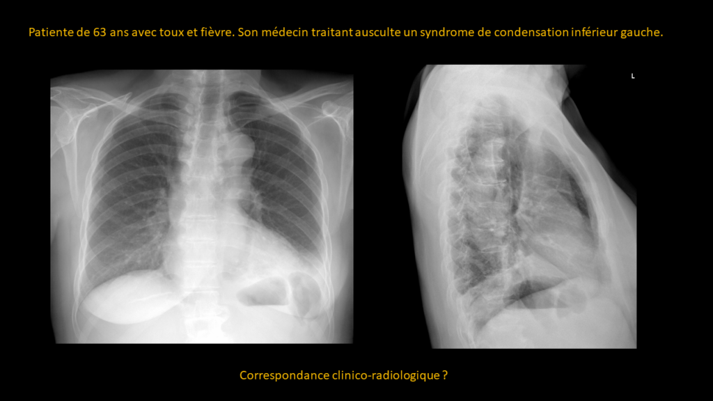 Question thorax