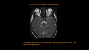 Question cerveau