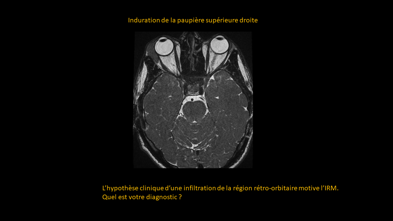 Question cerveau